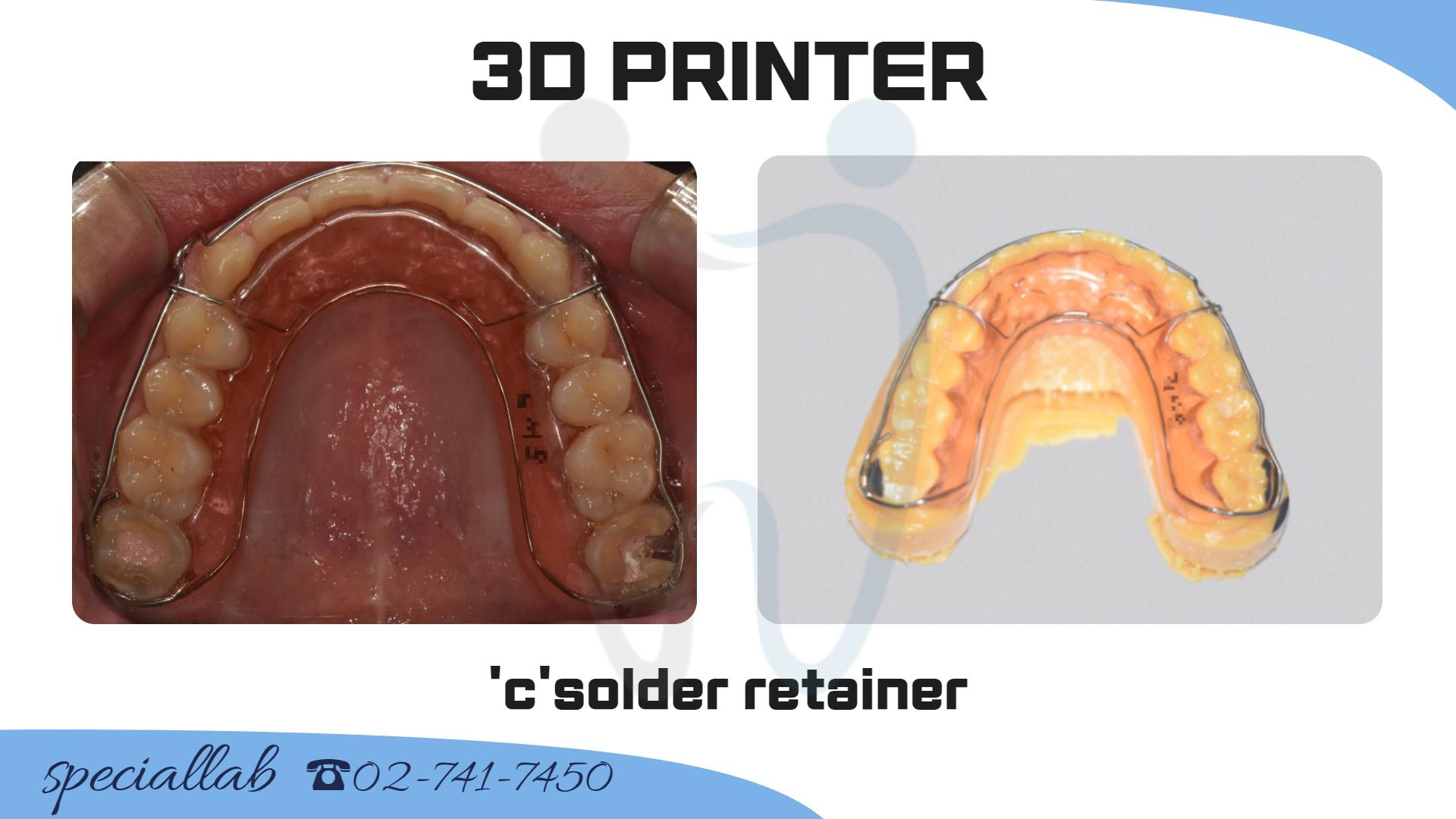 Herbst 코골이 장치